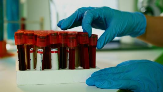 Blood 3 - Endocrinology, toxicity, and other tests