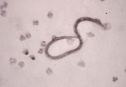 3 days: Parasitic & fungal conditions (Masterclass)